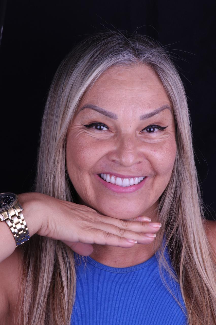 Prótese protocolo dentária fixa sobre fundo branco na Smile Center, em José Bonifácio, Zona Leste SP.