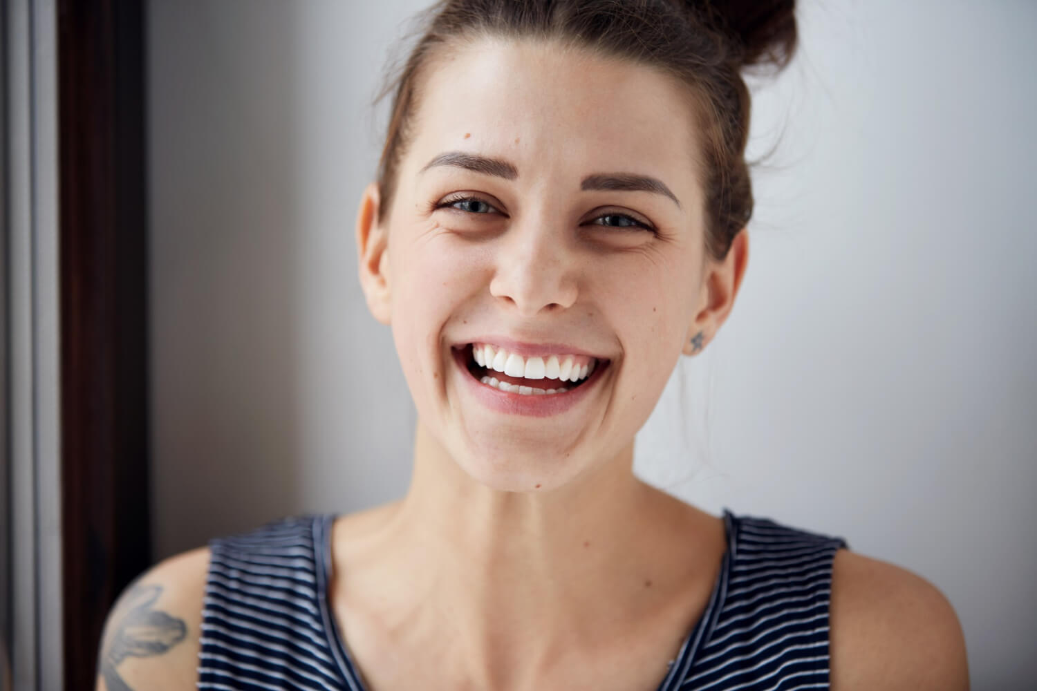 Mulher sorrindo mostrando dentes brancos e gengiva saudável após gengivoplastia na Smile Center, José Bonifácio, Zona Leste SP.