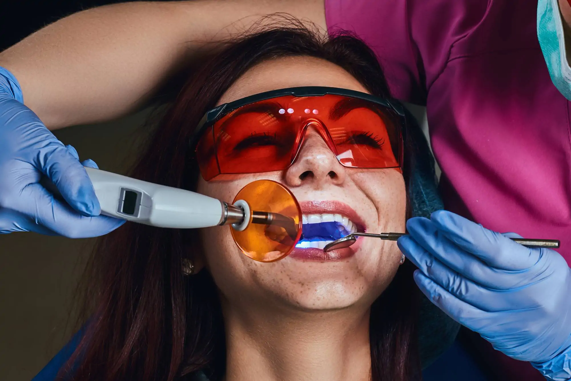 Paciente realizando clareamento dental a laser com proteção ocular na Smile Center, José Bonifácio, Zona Leste SP.