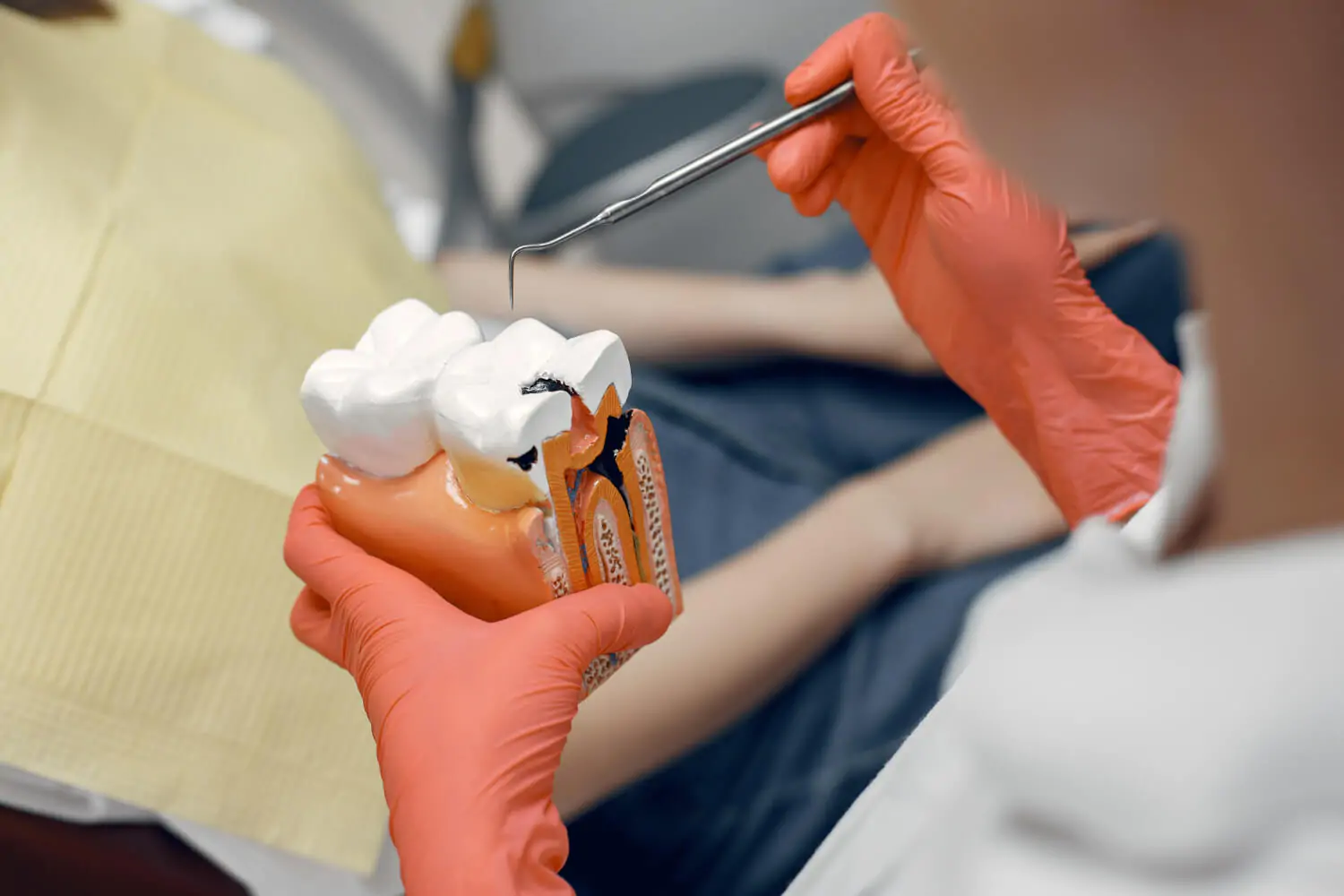 Dentista com luvas rosa segurando macromodelo de dente com cárie na Smile Center, em José Bonifácio, Zona Leste SP.